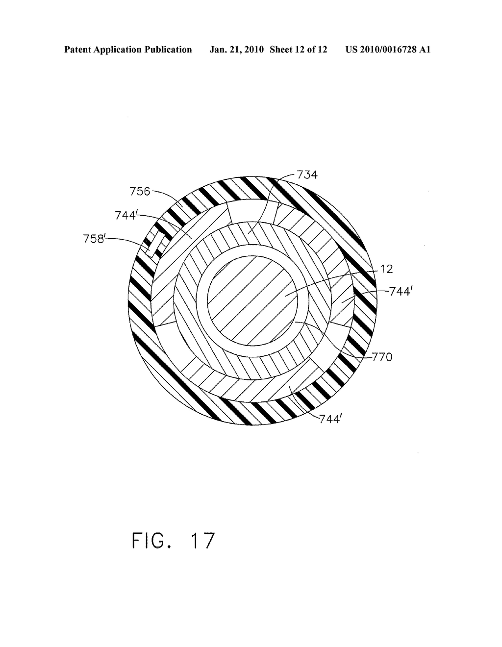 Magnetostrictive actuator of a medical ultrasound transducer assembly, and a medical ultrasound handpiece and a medical ultrasound system having such actuator - diagram, schematic, and image 13