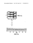 Method of Assessing Blood Volume Using Photoelectric Plethysmography diagram and image