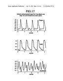 Method of Assessing Blood Volume Using Photoelectric Plethysmography diagram and image