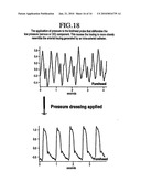 Method of Assessing Blood Volume Using Photoelectric Plethysmography diagram and image