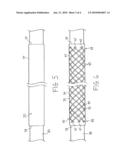 INTRODUCER SHEATH HAVING A BRAIDED MEMBER AND METHODS OF MANUFACTURE diagram and image