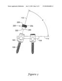 APPARATUS FOR CONNECTING A LONGITUDINAL MEMBER TO A BONE PORTION diagram and image