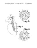 Upload shank swivel head bone screw spinal implant diagram and image