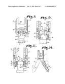 Upload shank swivel head bone screw spinal implant diagram and image