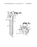 Upload shank swivel head bone screw spinal implant diagram and image