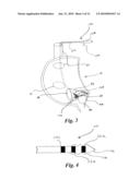 CARDIAC PACING USING THE INFERIOR NODAL EXTENSION diagram and image