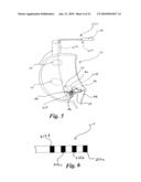 CARDIAC PACING USING THE INFERIOR NODAL EXTENSION diagram and image