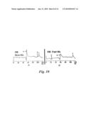 CARDIAC PACING USING THE INFERIOR NODAL EXTENSION diagram and image