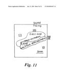 CARDIAC PACING USING THE INFERIOR NODAL EXTENSION diagram and image