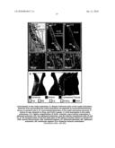 CARDIAC PACING USING THE INFERIOR NODAL EXTENSION diagram and image