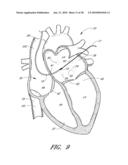 METHOD FOR DIGITAL CARDIAC RHYTHM MANAGEMENT diagram and image