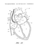 METHOD FOR DIGITAL CARDIAC RHYTHM MANAGEMENT diagram and image