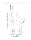 METHOD FOR DIGITAL CARDIAC RHYTHM MANAGEMENT diagram and image