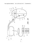 METHOD FOR DIGITAL CARDIAC RHYTHM MANAGEMENT diagram and image