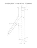 ADVANCED ENDOVASCULAR GRAFT DELIVERY SYSTEM AND METHOD OF TREATMENT diagram and image