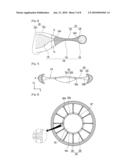 Intraocular Lens Assembly diagram and image