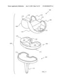 KNEE PROSTHESES WITH ENHANCED KINEMATICS diagram and image