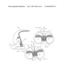 KNEE PROSTHESES WITH ENHANCED KINEMATICS diagram and image