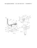 KNEE PROSTHESES WITH ENHANCED KINEMATICS diagram and image