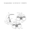 KNEE PROSTHESES WITH ENHANCED KINEMATICS diagram and image