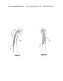 HIP PROTECTOR IMPLANT diagram and image