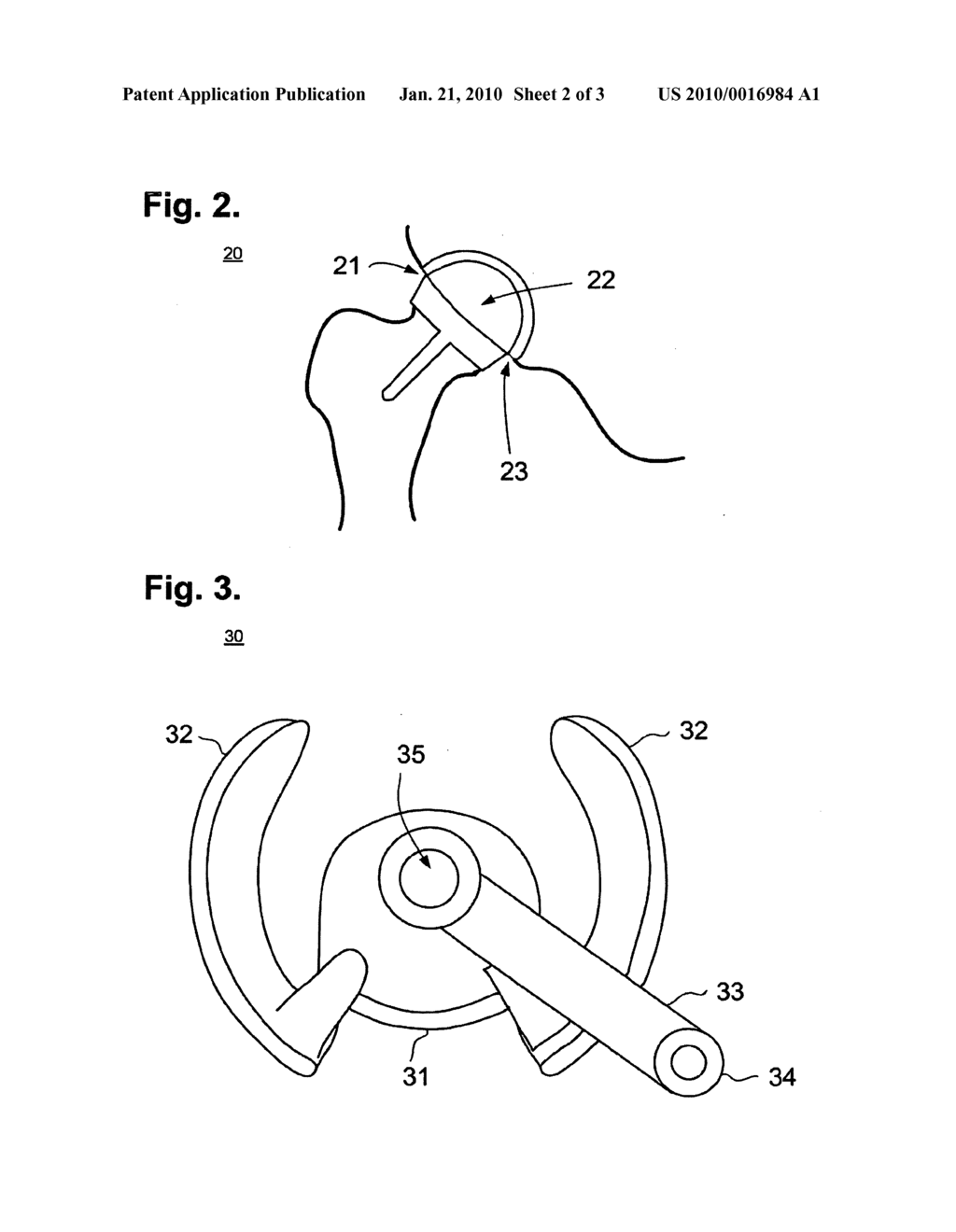 Acetabulum Surgical Resurfacing Aid - diagram, schematic, and image 03