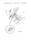 Safety Cutting Apparatus diagram and image