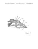 SCREENING APPARATUS diagram and image