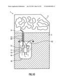 Chip module, sim card, wireless device and wireless communication method diagram and image