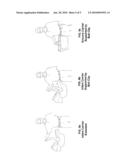 Infant Carrier Support diagram and image