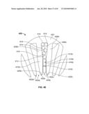 THERMALLY MATCHED COMPOSITE SLEEVE diagram and image