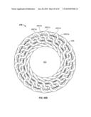 THERMALLY MATCHED COMPOSITE SLEEVE diagram and image