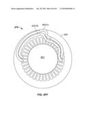 THERMALLY MATCHED COMPOSITE SLEEVE diagram and image