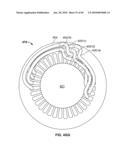 THERMALLY MATCHED COMPOSITE SLEEVE diagram and image