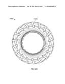 THERMALLY MATCHED COMPOSITE SLEEVE diagram and image