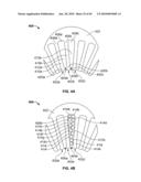 END TURN CONFIGURATION OF AN ELECTRIC MACHINE diagram and image