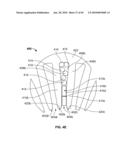 END TURN CONFIGURATION OF AN ELECTRIC MACHINE diagram and image