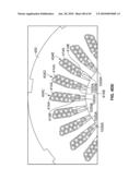 END TURN CONFIGURATION OF AN ELECTRIC MACHINE diagram and image