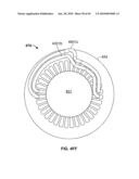 END TURN CONFIGURATION OF AN ELECTRIC MACHINE diagram and image