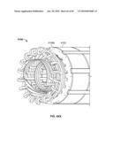 END TURN CONFIGURATION OF AN ELECTRIC MACHINE diagram and image