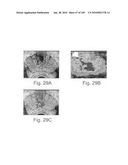 IMAGING PROTOCOLS diagram and image