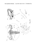 IMAGING PROTOCOLS diagram and image