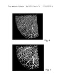 RADIOGRAPHIC CONTRAST AGENT FOR POSTMORTEM, EXPERIMENTAL AND DIAGNOSTIC ANGIOGRAPHY diagram and image