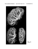 RADIOGRAPHIC CONTRAST AGENT FOR POSTMORTEM, EXPERIMENTAL AND DIAGNOSTIC ANGIOGRAPHY diagram and image