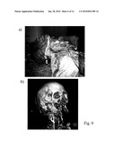 RADIOGRAPHIC CONTRAST AGENT FOR POSTMORTEM, EXPERIMENTAL AND DIAGNOSTIC ANGIOGRAPHY diagram and image