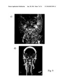 RADIOGRAPHIC CONTRAST AGENT FOR POSTMORTEM, EXPERIMENTAL AND DIAGNOSTIC ANGIOGRAPHY diagram and image