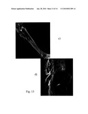 RADIOGRAPHIC CONTRAST AGENT FOR POSTMORTEM, EXPERIMENTAL AND DIAGNOSTIC ANGIOGRAPHY diagram and image