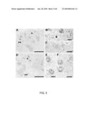 METHOD OF PREPARING LUNG ALVEOLAR EPITHELIAL TYPE II CELLS DERIVED FROM EMBRYONIC STEM CELLS diagram and image