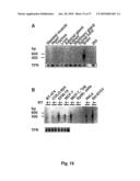 METHOD OF DETECTING A CANCER CELL BY ABERRANT EXPRESSION OF A HUMAN K+ ION CHANNEL diagram and image