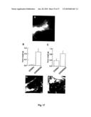 METHOD OF DETECTING A CANCER CELL BY ABERRANT EXPRESSION OF A HUMAN K+ ION CHANNEL diagram and image